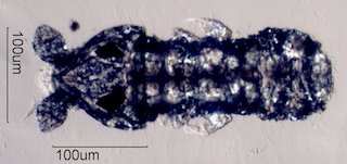 Springtail (Hypogastruridae)