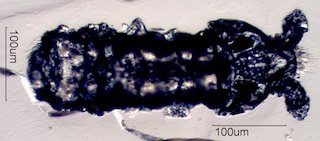 Springtail (Hypogastruridae)