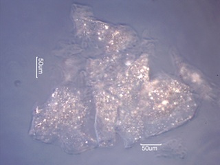 Aluminum Corrosion Debris