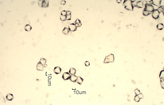Cesium Alum Test for Aluminum