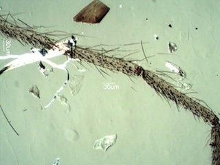 Insect Leg Fragment