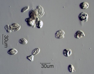 Pollen from Honeybee Frass