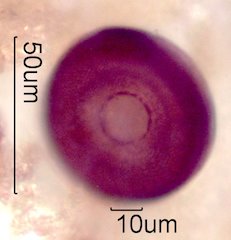 Arcella vulgaris