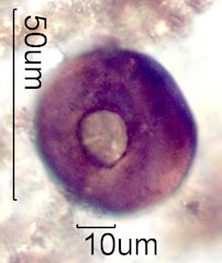Arcella vulgaris