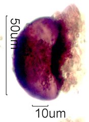 Arcella vulgaris