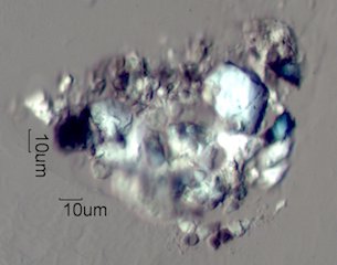 Concrete Dust Under the Microscope