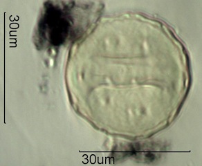Periporate Pollen