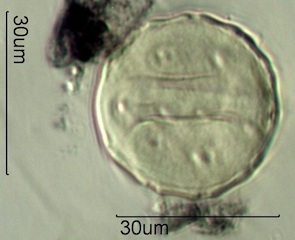 Periporate Pollen