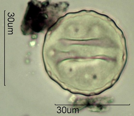 Periporate Pollen