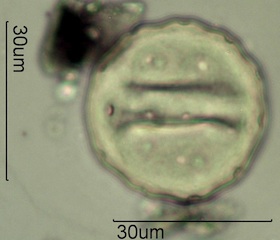 Periporate Pollen