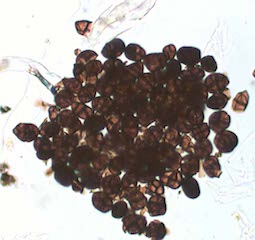 Stemphylium Spores