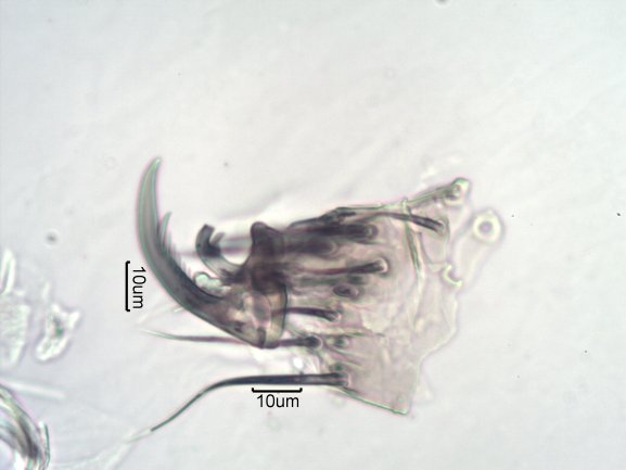 foot of Spider