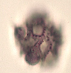 Pollen from Swedish Honey Under the Microscope