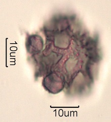 Pollen from Swedish Honey Under the Microscope