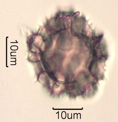 Pollen from Swedish Honey Under the Microscope