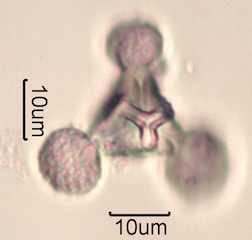 Pollen from Swedish Honey Under the Microscope