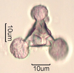 Pollen from Swedish Honey Under the Microscope
