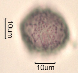 Pollen from Swedish Honey Under the Microscope