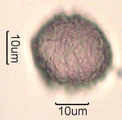 Pollen from Swedish Honey Under the Microscope