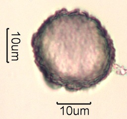 Pollen from Swedish Honey Under the Microscope