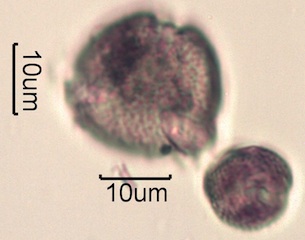 Pollen from Swedish Honey Under the Microscope