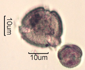 Pollen from Swedish Honey Under the Microscope