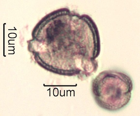 Pollen from Swedish Honey Under the Microscope