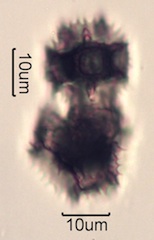 Pollen from Swedish Honey Under the Microscope