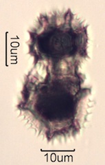 Pollen from Swedish Honey Under the Microscope