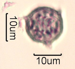 Pollen from Swedish Honey Under the Microscope