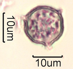 Pollen from Swedish Honey Under the Microscope