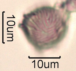 Strawberry Pollen from Swedish Honey Under the Microscope