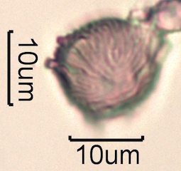 Strawberry Pollen from Swedish Honey Under the Microscope