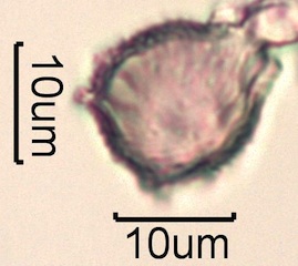 Strawberry Pollen from Swedish Honey Under the Microscope