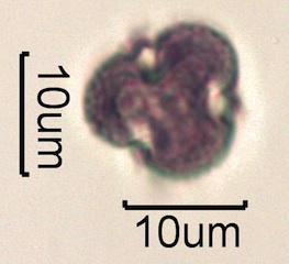 Pollen from Swedish Honey Under the Microscope
