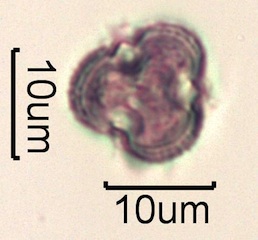 Pollen from Swedish Honey Under the Microscope