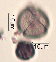 Pollen from Swedish Honey Under the Microscope