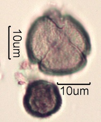 Pollen from Swedish Honey Under the Microscope