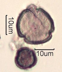 Pollen from Swedish Honey Under the Microscope
