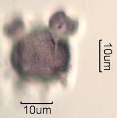 Pollen from Swedish Honey Under the Microscope