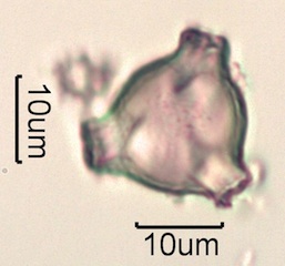 Pollen from Swedish Honey Under the Microscope