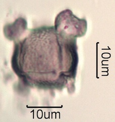 Pollen from Swedish Honey Under the Microscope