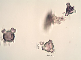 Pollen from Swedish Honey Under the Microscope