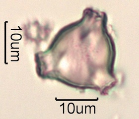 Pollen from Swedish Honey Under the Microscope