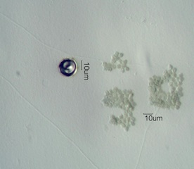 Algae