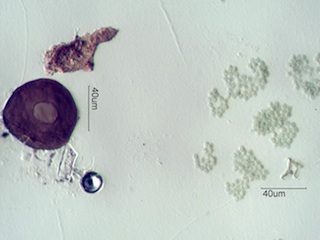 Algae