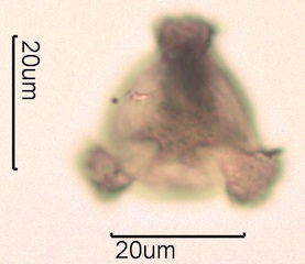 Pollen from Swedish Honey Under the Microscope