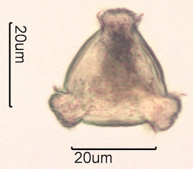 Pollen from Swedish Honey Under the Microscope