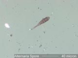 Alternaria Spore