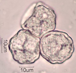 Elm (Ulmus sp.) Pollen Under the Microscope